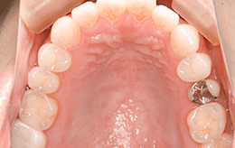 ケース2の治療前