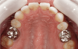 ケース3の治療前