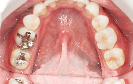 ケース4の治療前