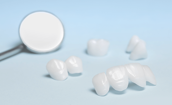 ラミネートベニア