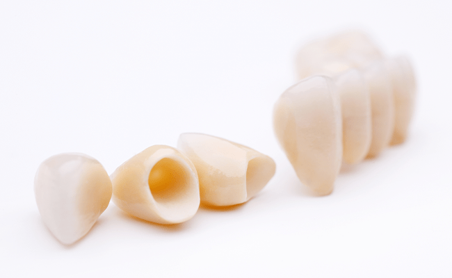 オールセラミック