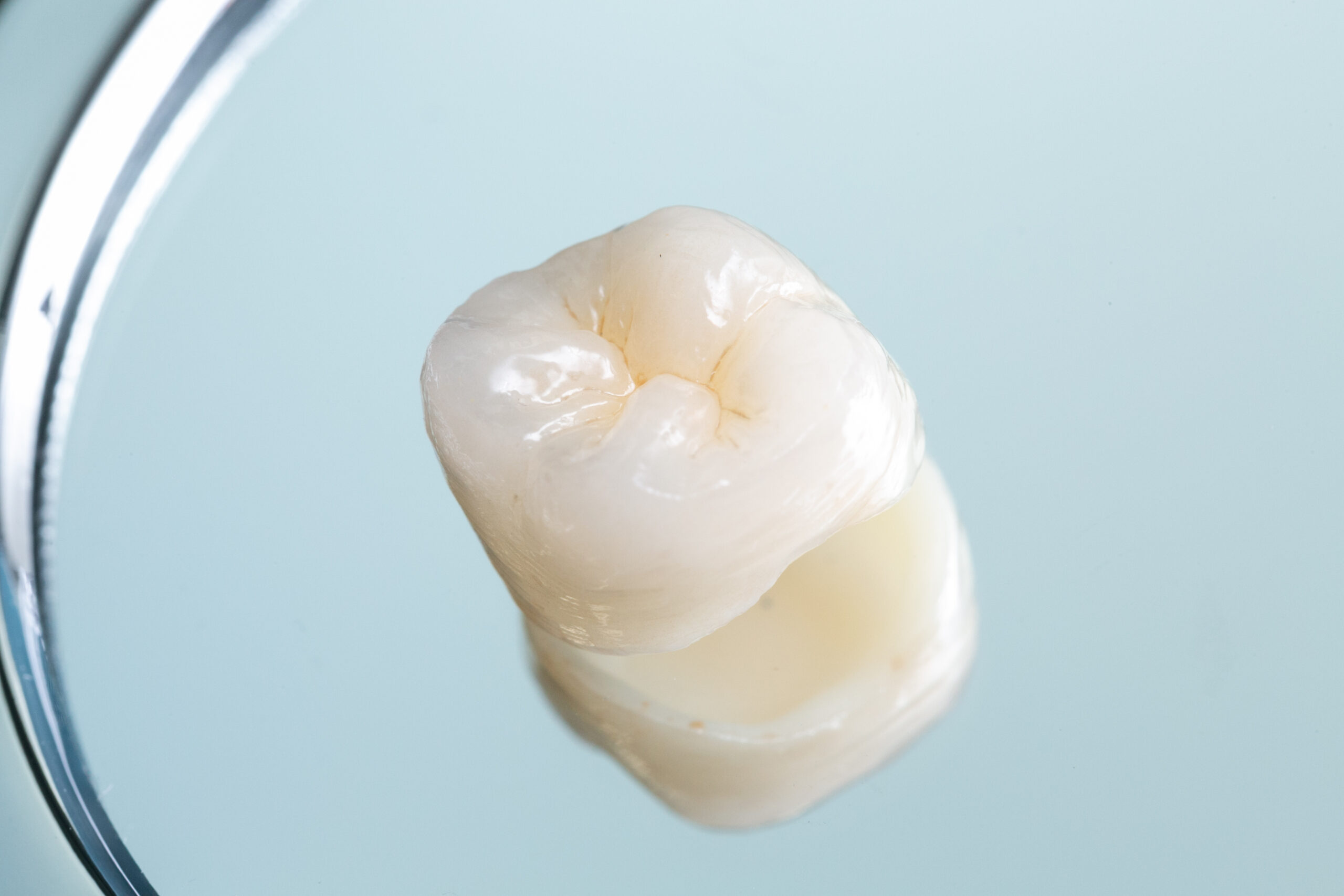 オールセラミック