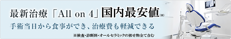 オールオン4専門サイト